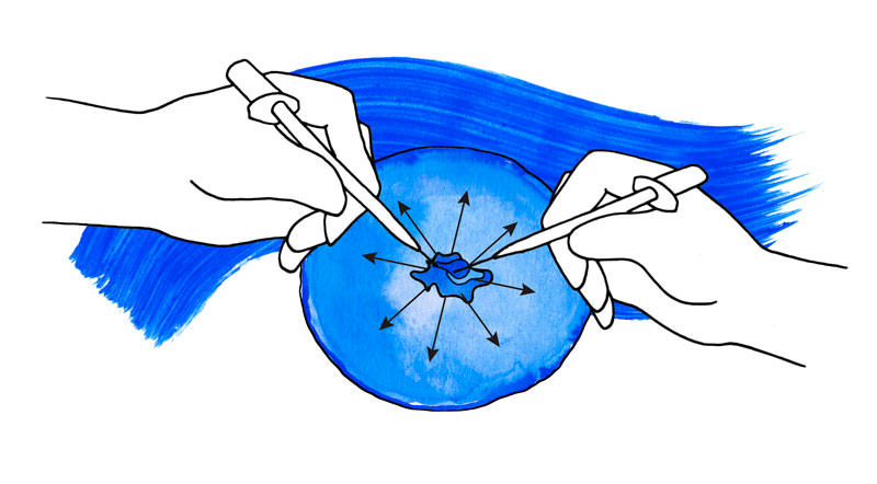 Descubrir 67+ biopsia dibujo muy caliente - camera.edu.vn