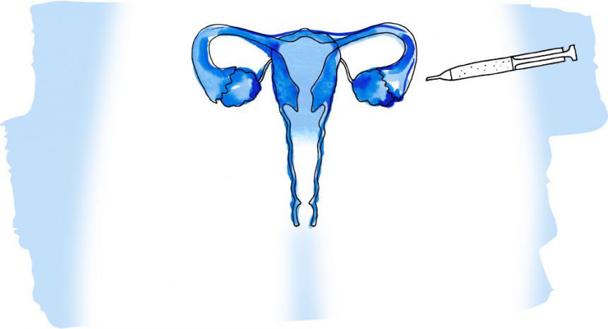 1. Stimulation of the ovary