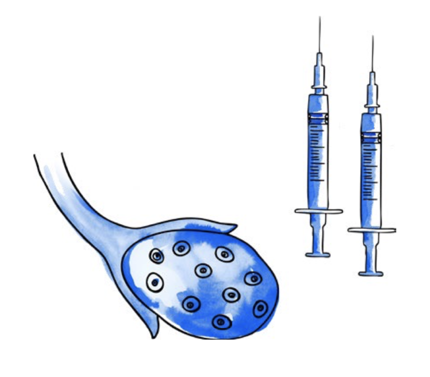 1. Estimulación ovárica 