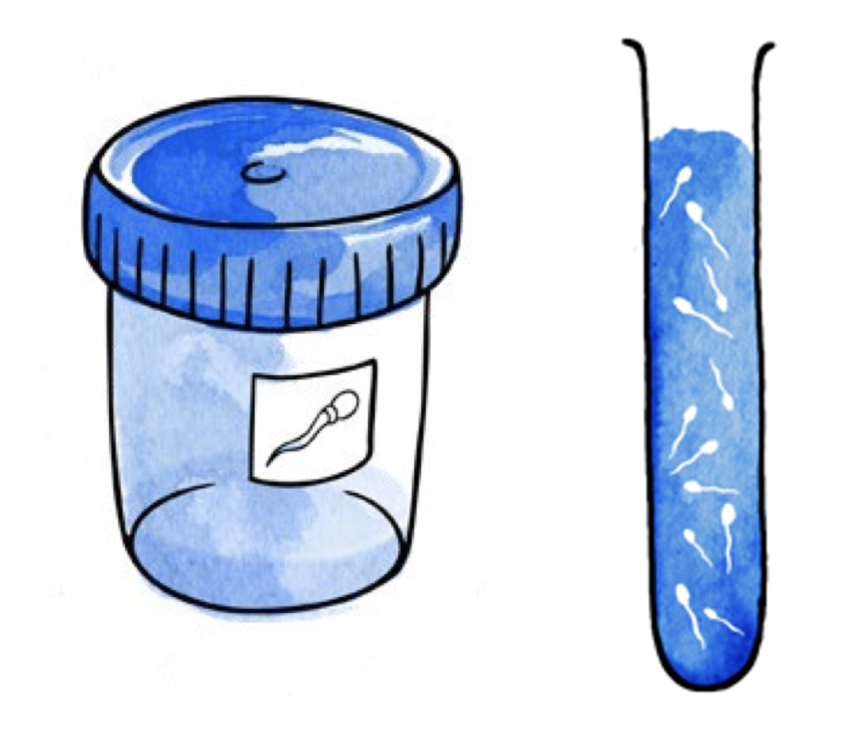 2. La capacitación del semen