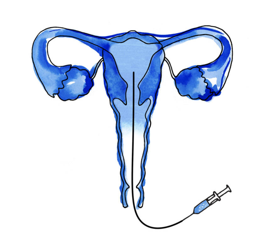 3. La inseminación 