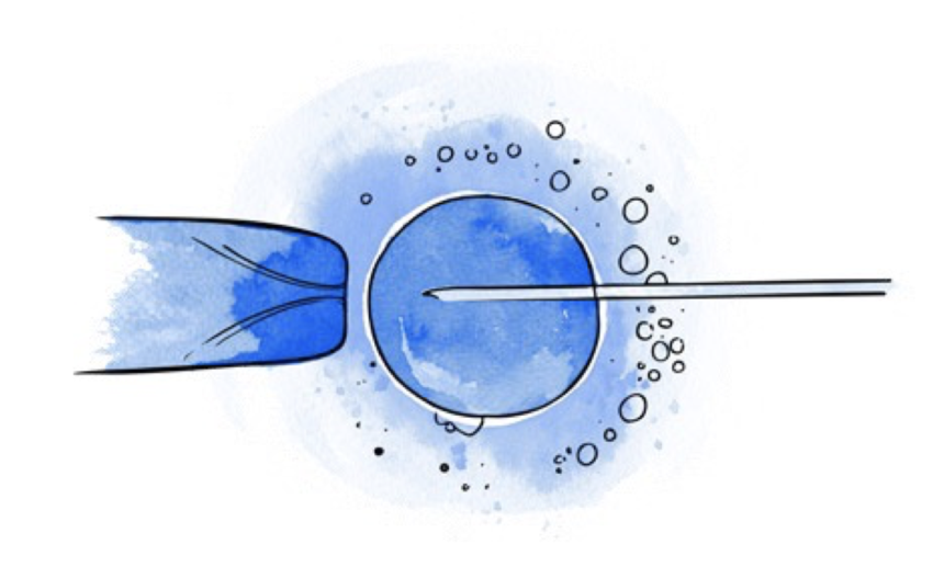 IVF – ICSI