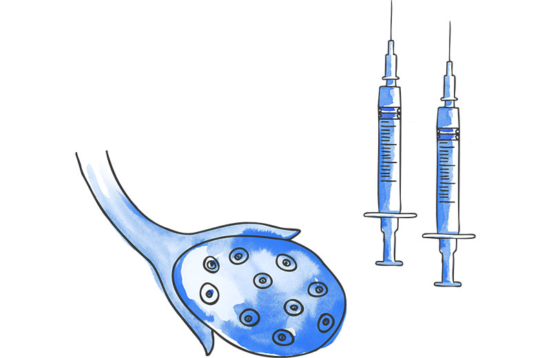 1. Stimolazione ovarica