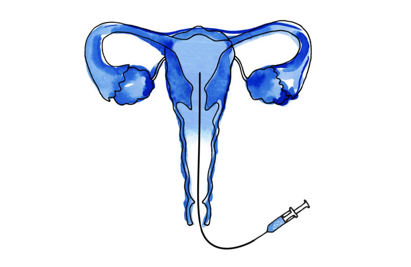 3. L'inseminazione 