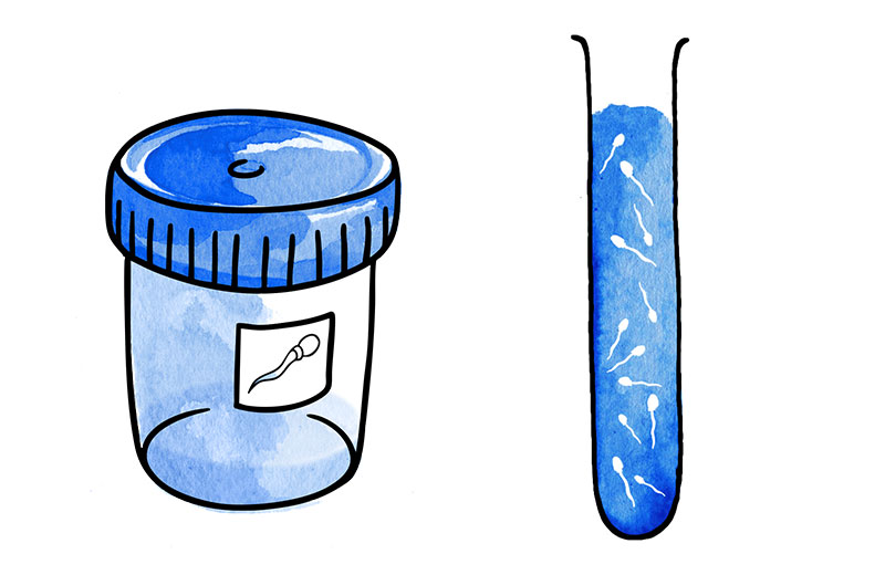 2. Capacitazione dello sperma